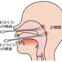 コロナへの油断は、みえない後遺症患者を増やす